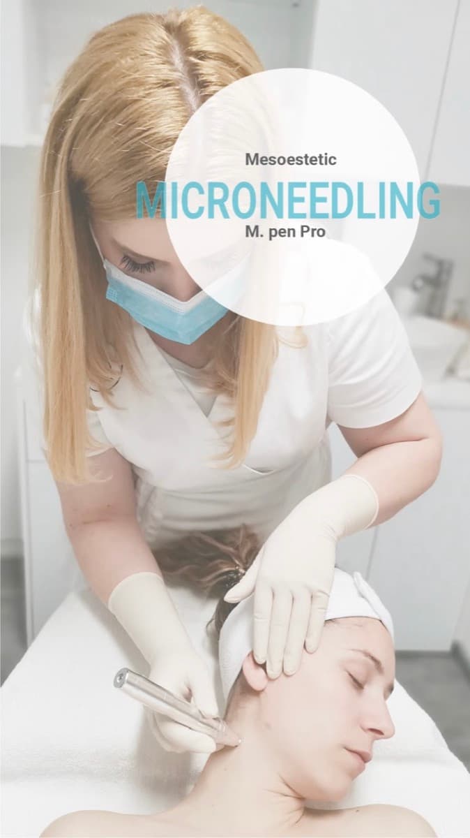 Microneedling z napravo m.pen v salonu AB Estetika